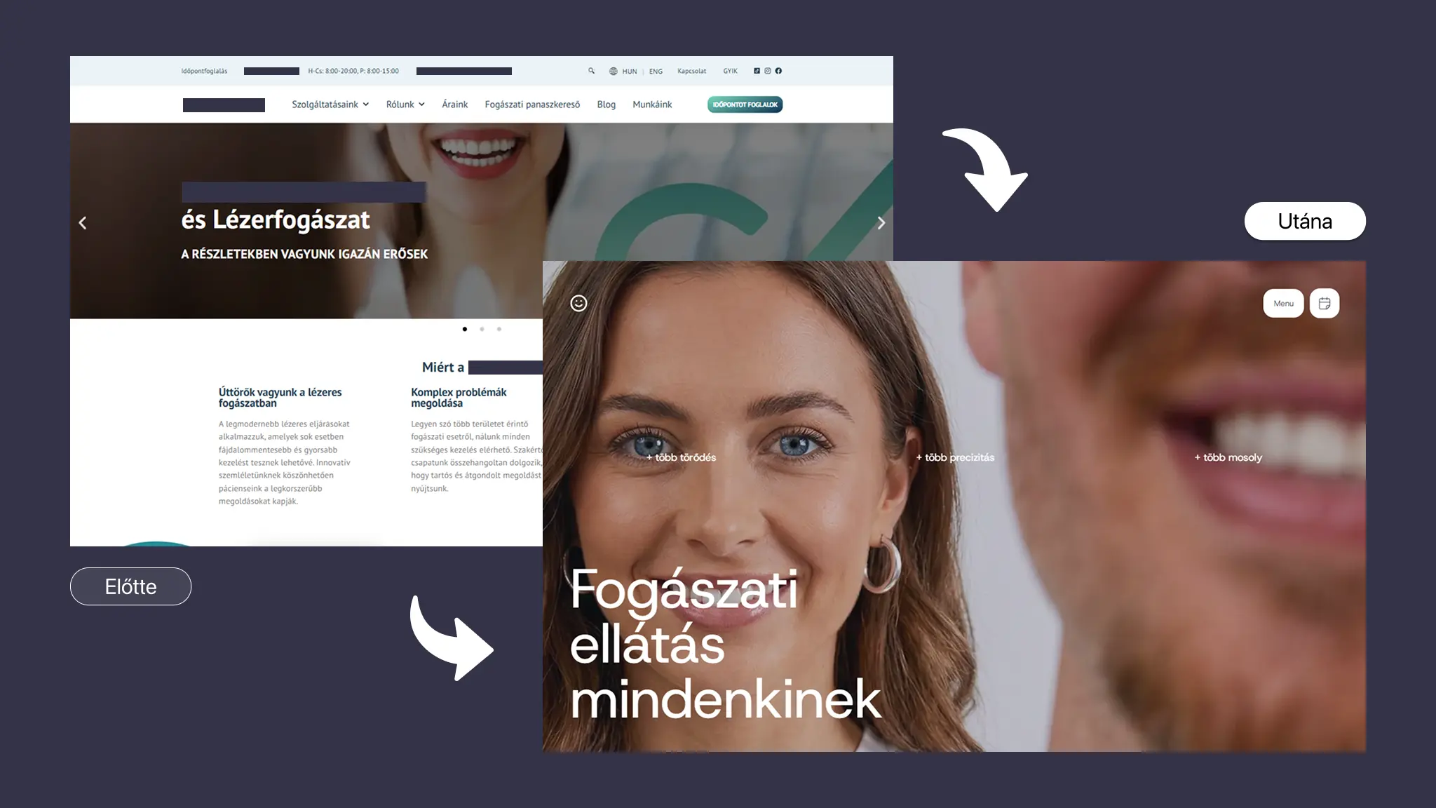 Sablon alapú fogászati weboldal és egyedi weboldal készítés összehasonlítása: bal oldalon egy zsúfolt, generikus WordPress sablon, jobb oldalon a Dentia prémium egyedi design, természetes portréfotóval és letisztult tipográfiával.