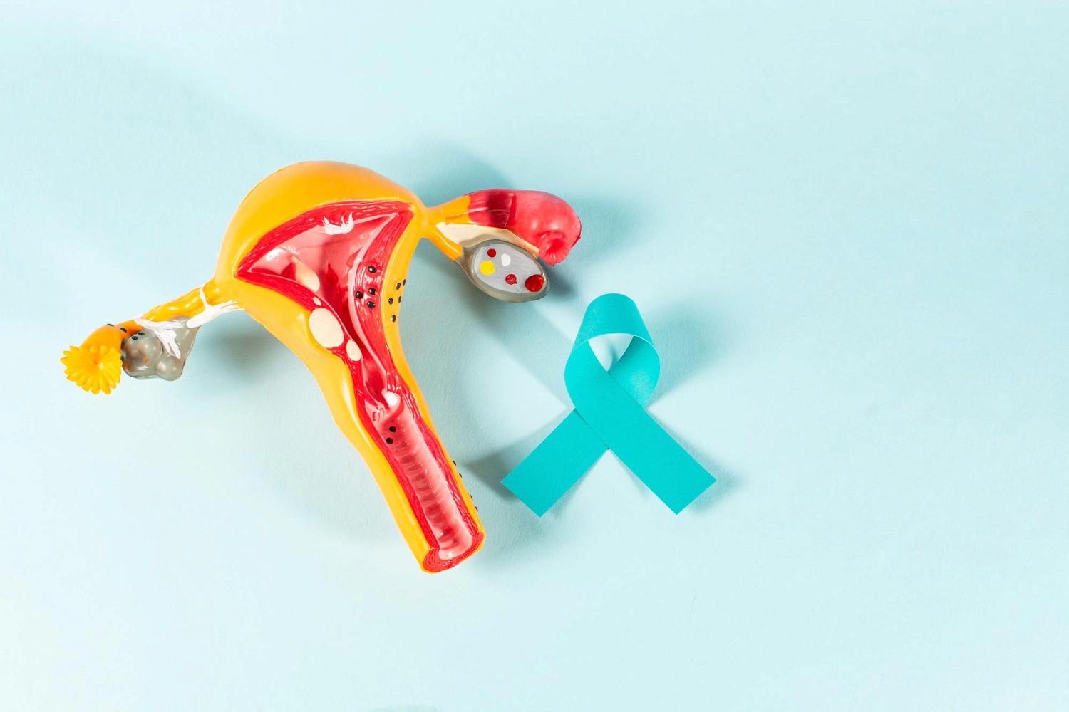 Ovarian Cancer and Fertility: What Every Woman Should Know