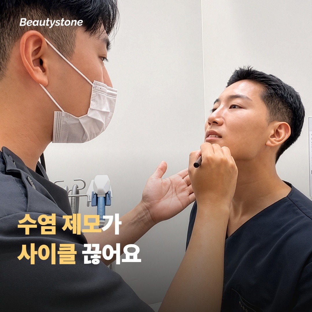 수염 제모가 모낭염 사이클을 끊어요
