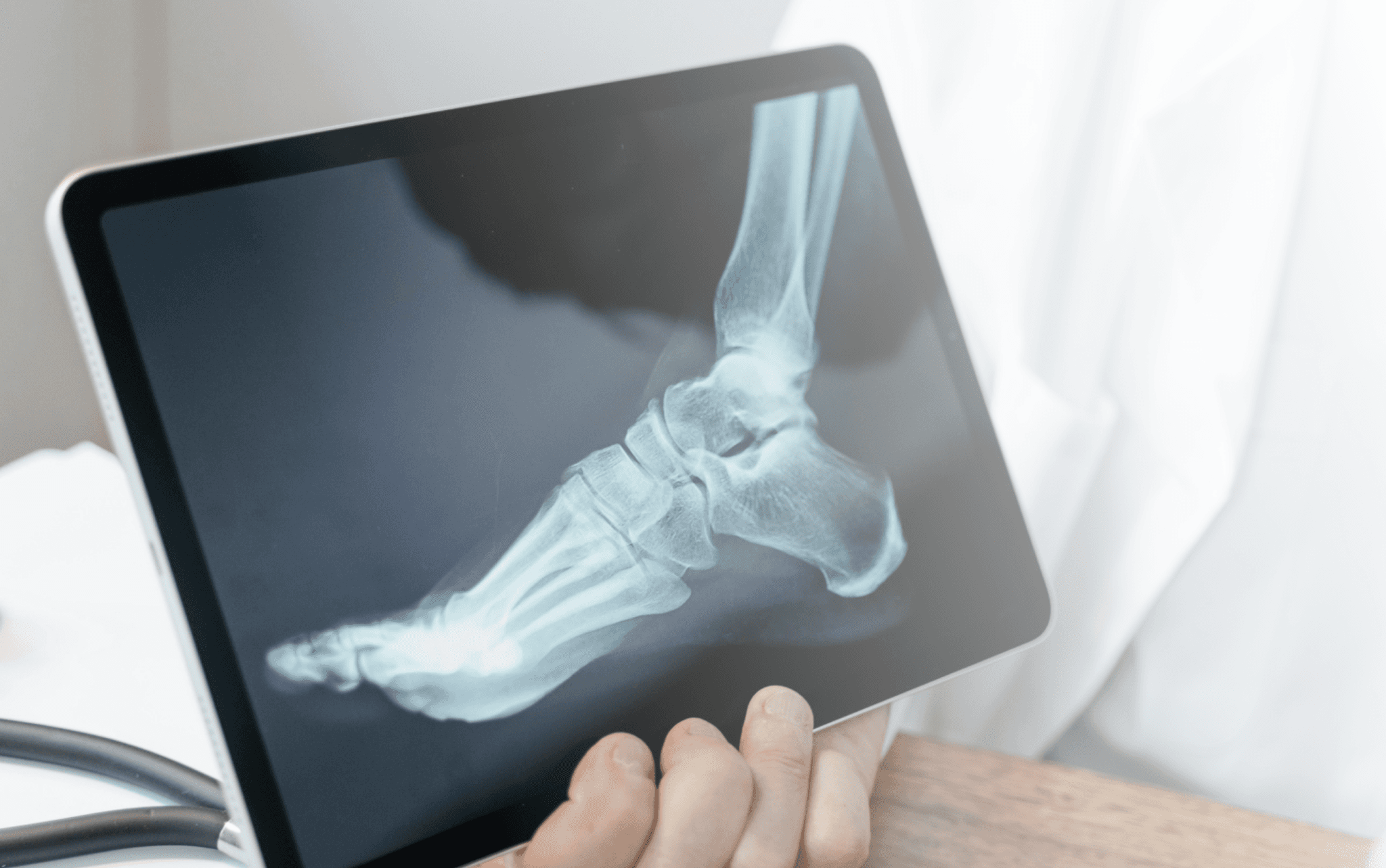 Röntgenbild eines Sprunggelenk auf einem iPad
