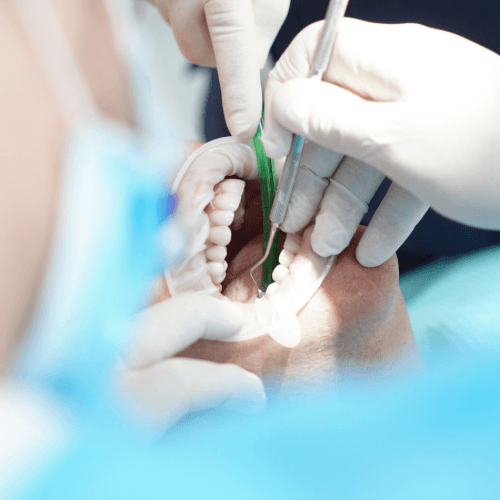 A patient reclines in a dental chair as a dentist places a dental crown during a teeth cleaning procedure.