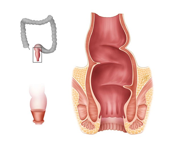 Illustration scientifique l'anatomie du rectum/canal anal/ anus en couleurs par l'illustratrice scientifique Élodie Ouellet-Belleau.