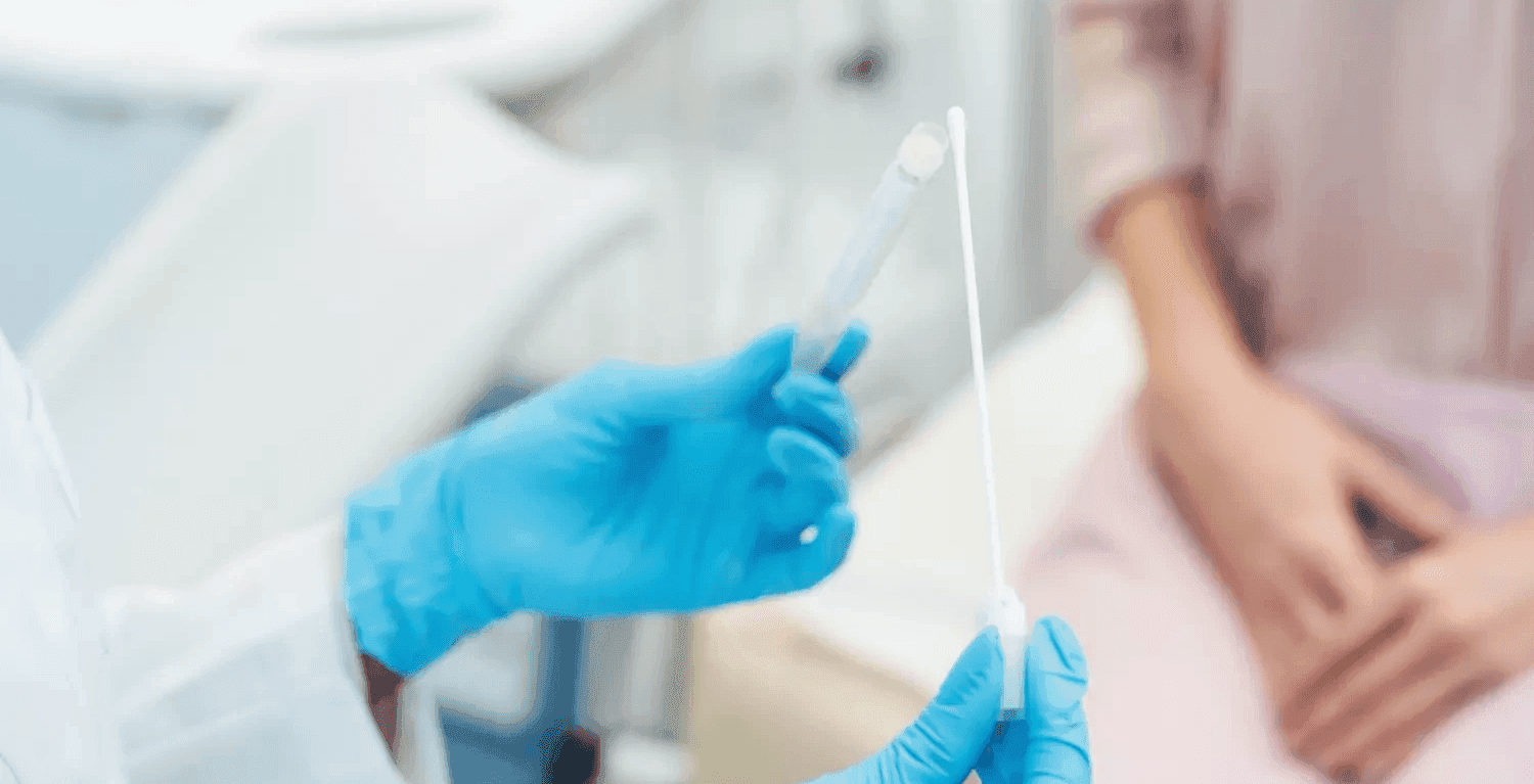 test mycose en laboratoire