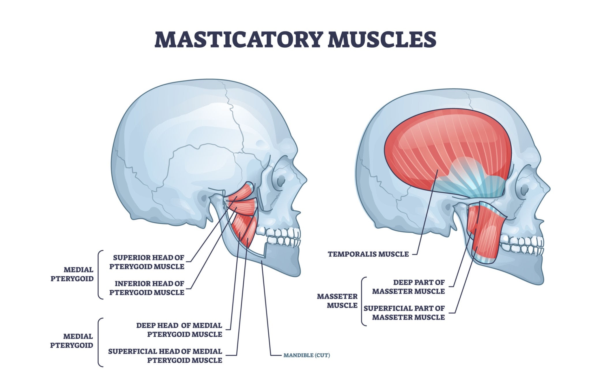 Image of a diagram showing the muscles of the jaw connecting to the head and neck