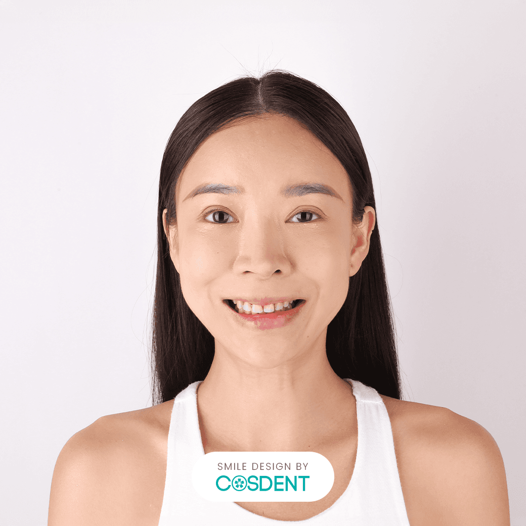 หน้าจีน ยิ้มกว้าง 19 ซี่