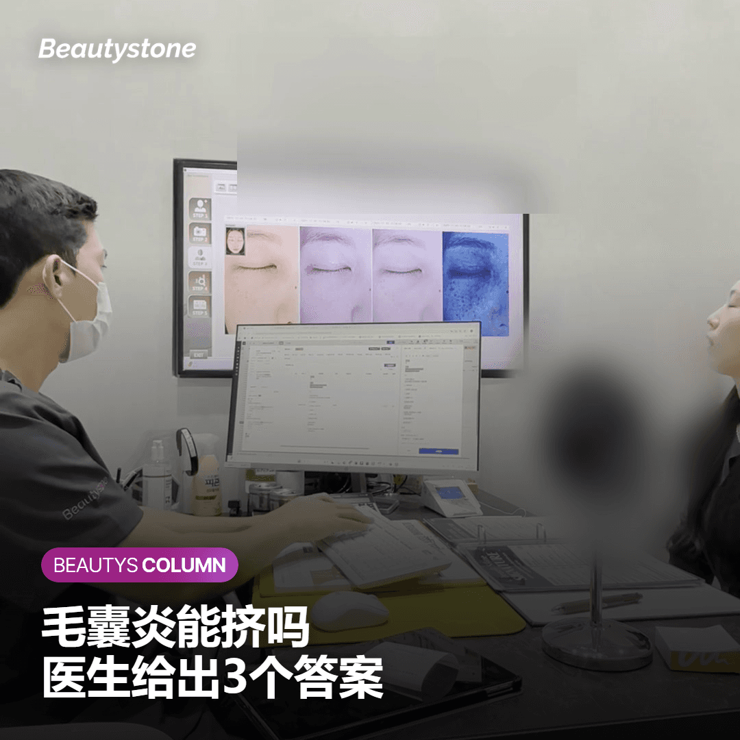 毛囊炎挤压、治疗及疗程时间的FAQ问答
