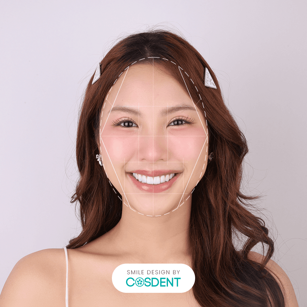 หน้ารูปไข่ ยิ้มกว้าง 20 ซี่