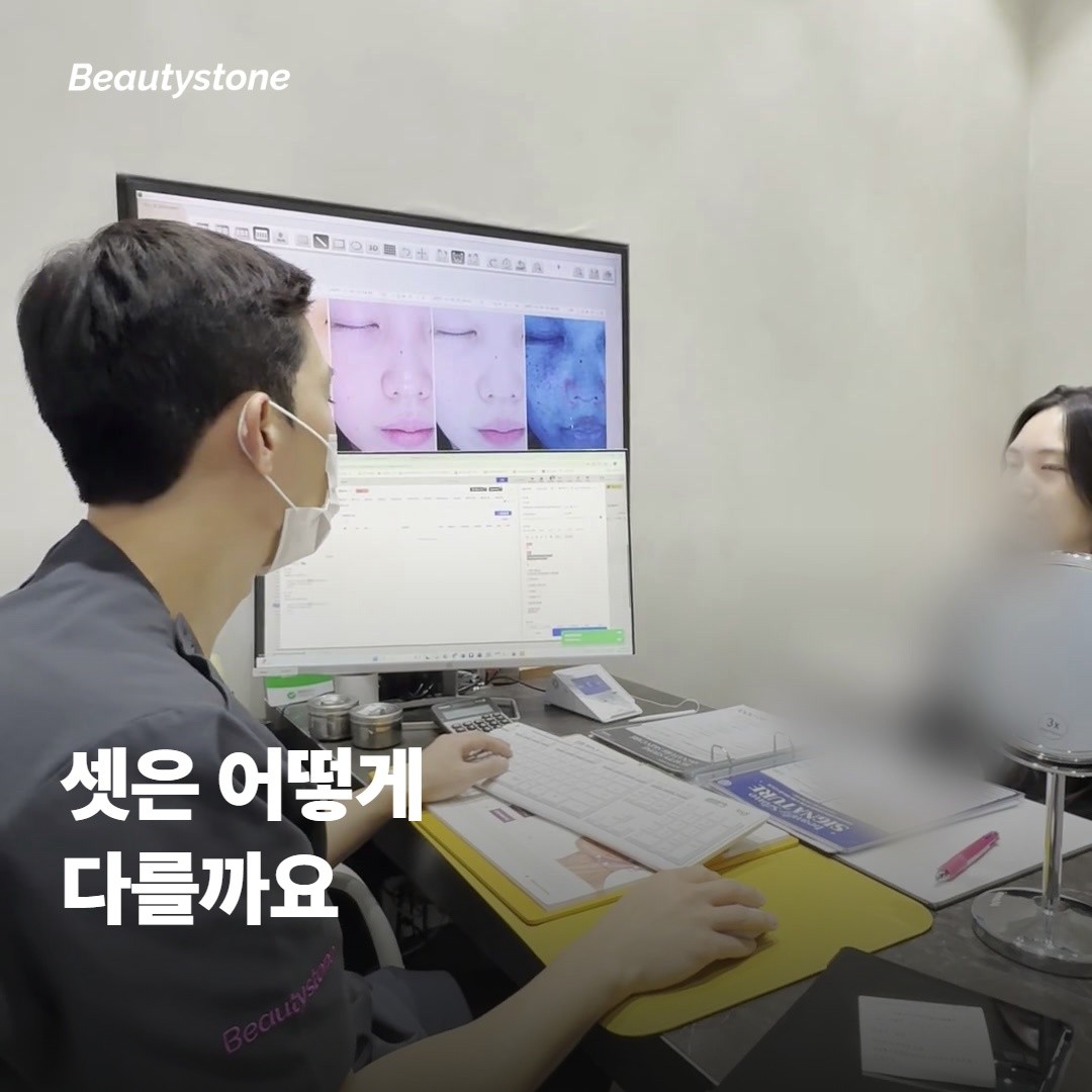 잡티·기미·주근깨가 어떻게 다른지부터