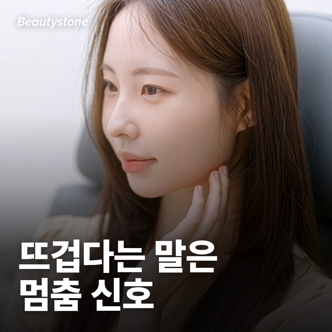 예민한 데라 화상 날까 봐 무서워요
