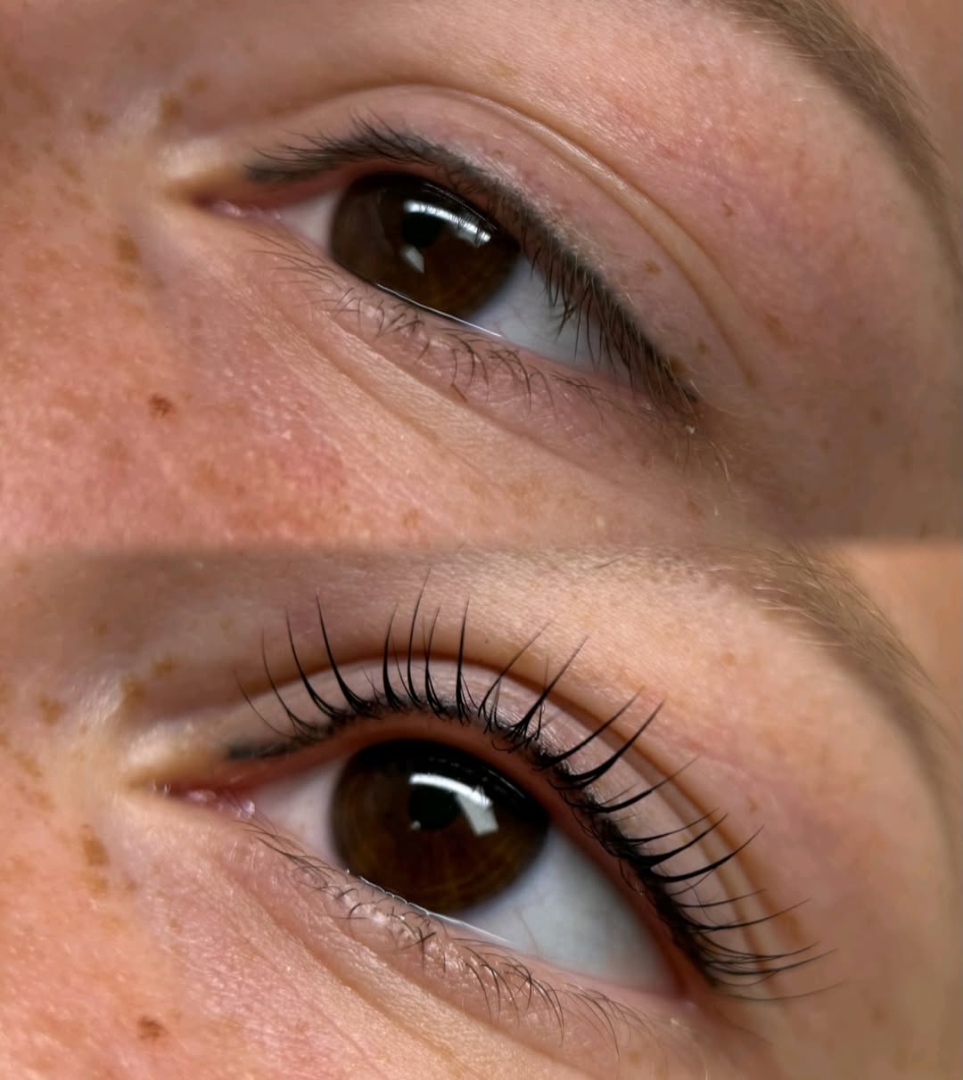 Crop view of an eye, before and after the procedure