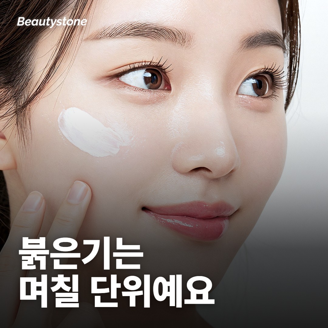 포텐자 붉은기, 며칠이면 가라앉아요?