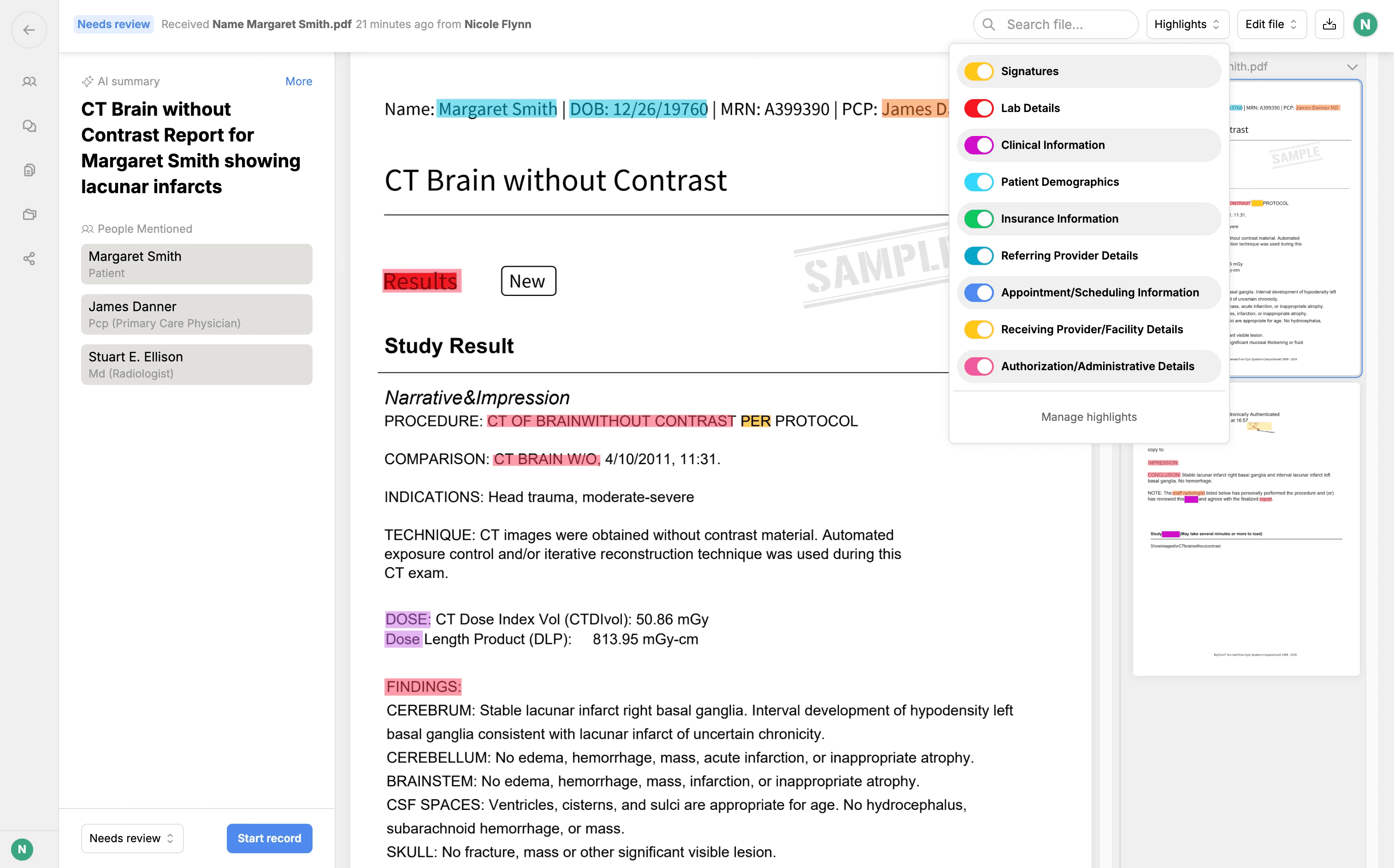 Highpass makes find things easier 