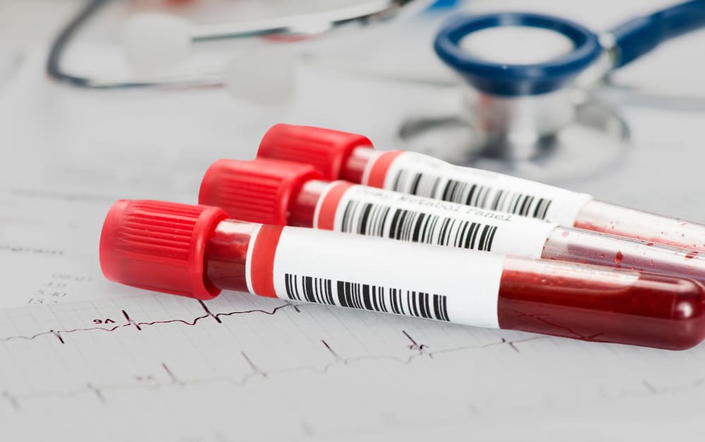 Blood Tests for Cancer Diagnosis: Myths vs. Facts