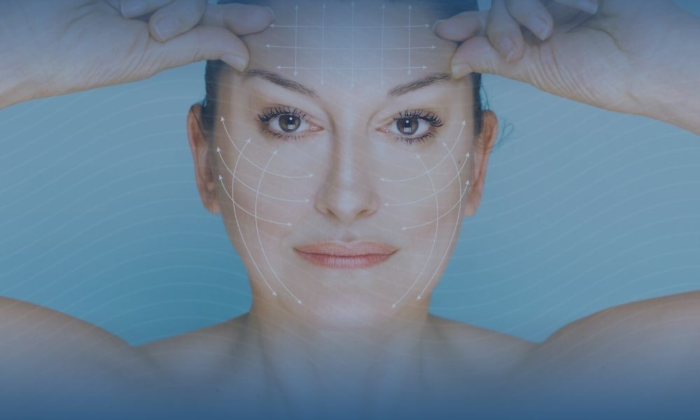 mulher de frente com marcações na pele de deep plane lifting facial