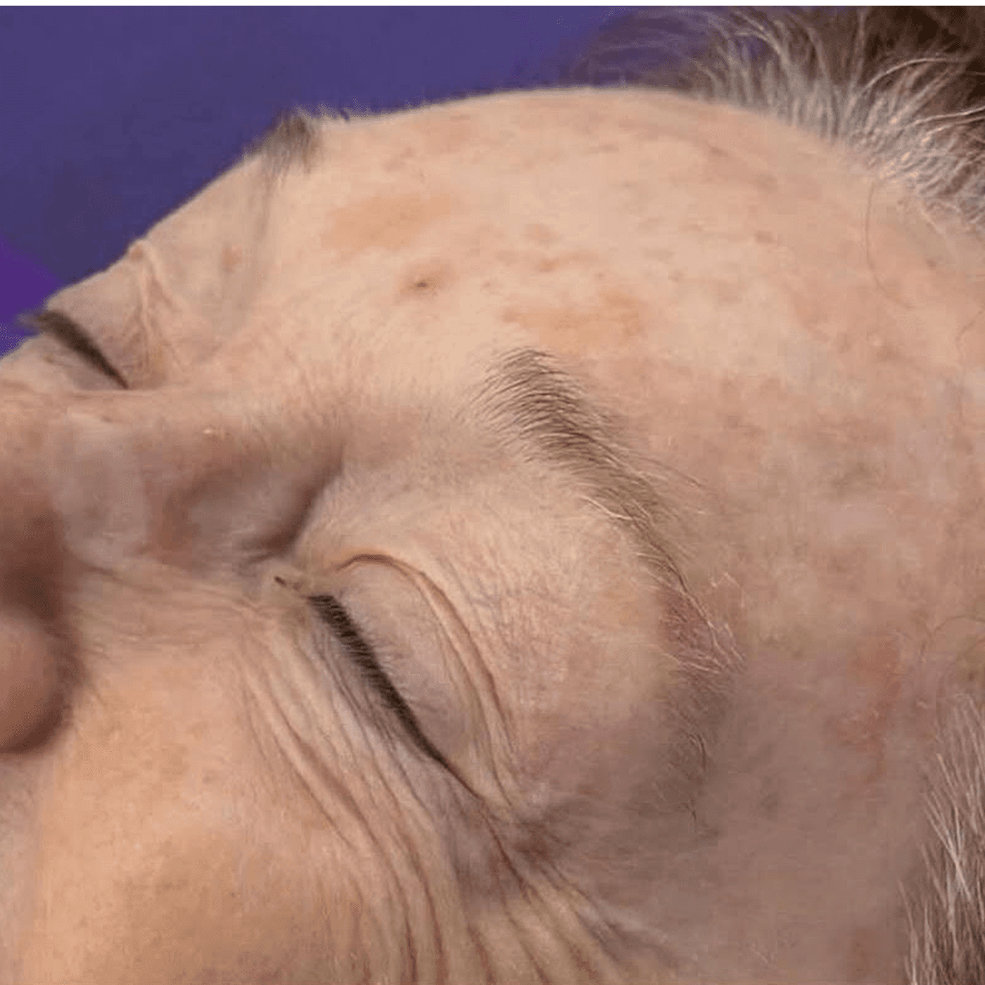 Medical Esthetics & Wellness Brow Tint