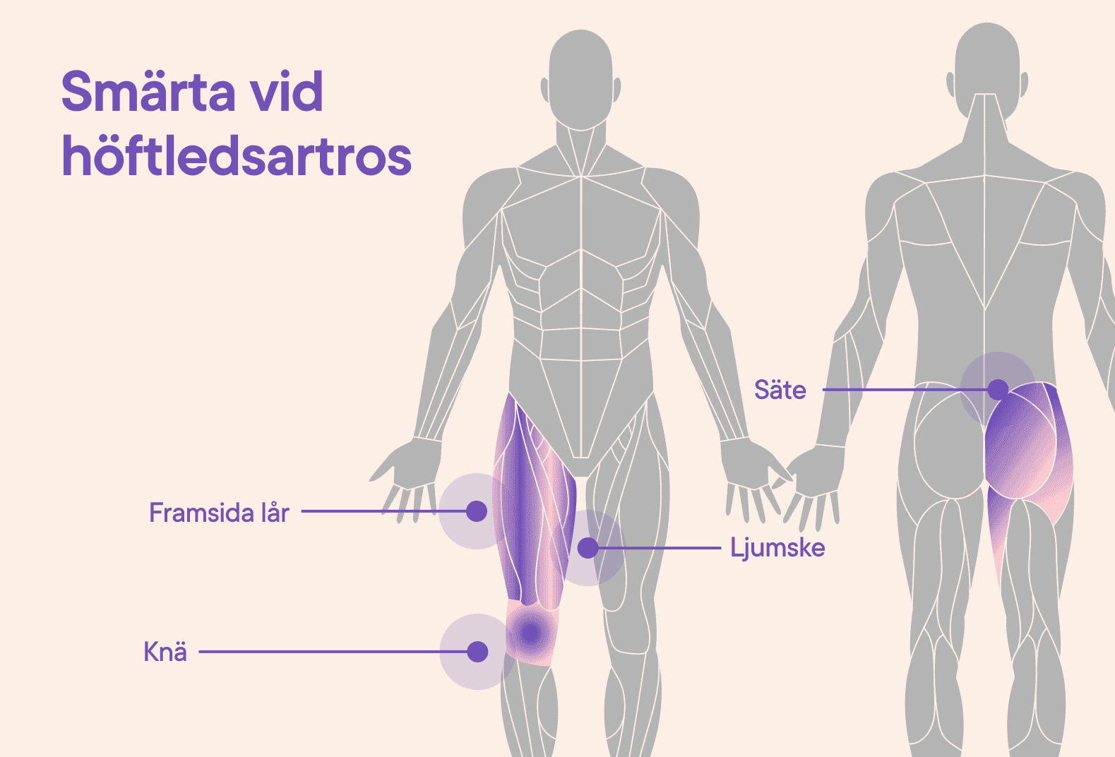 Illustration av smärtan vid höftledsartros.png