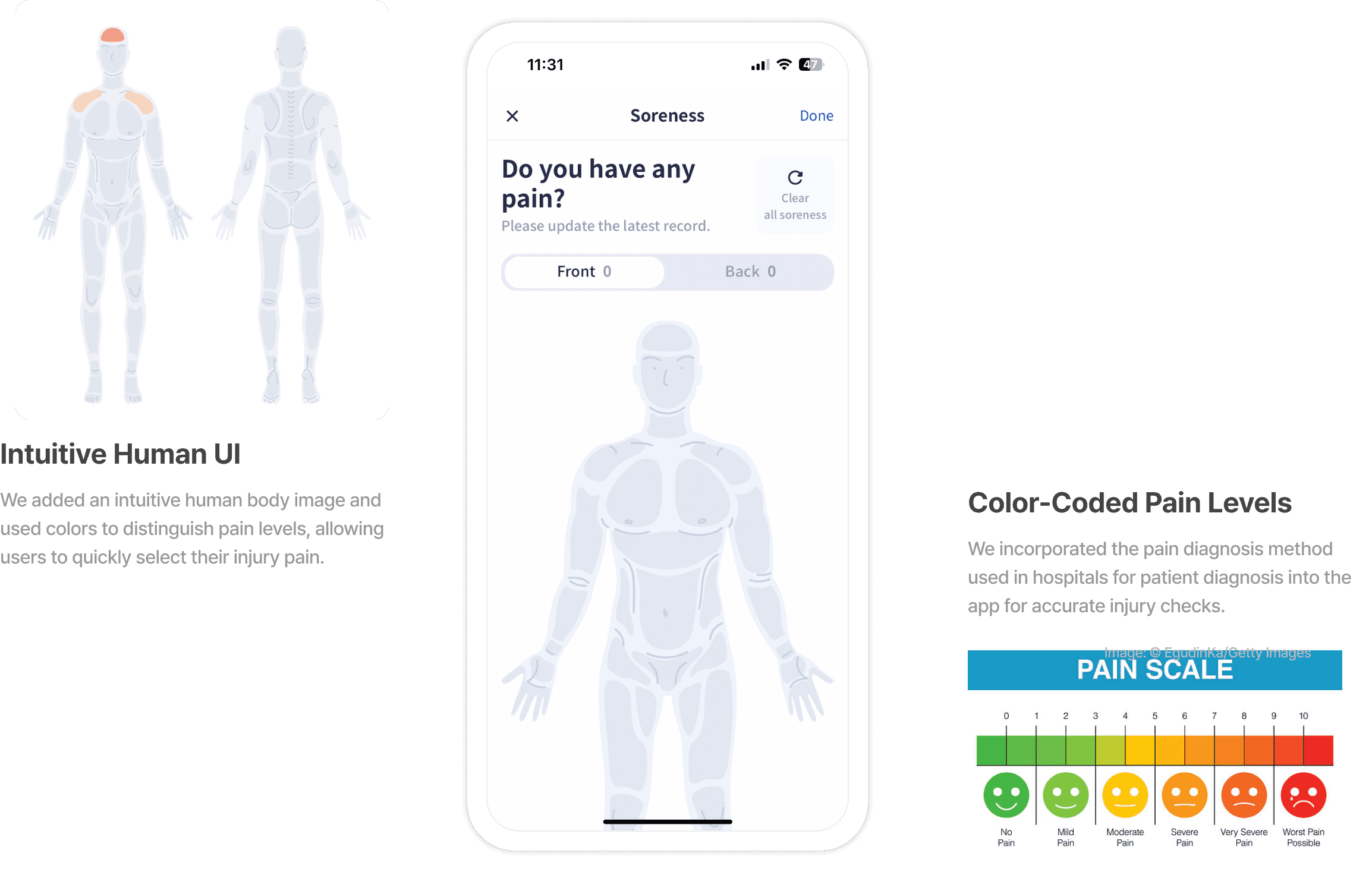 Streamlined injury data logging process