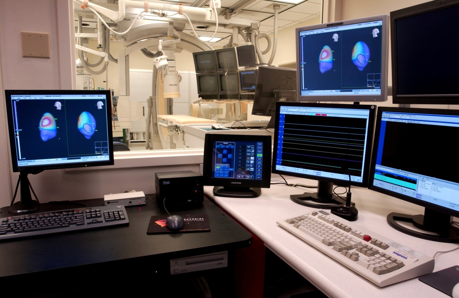 Pediatric catheterization software