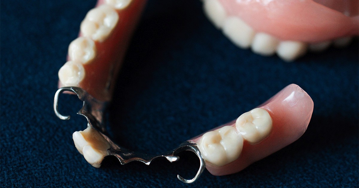 Protesi Mobile Studio Dentistico D'Agostino