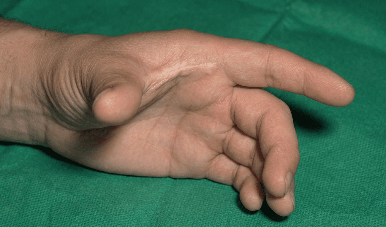 Clinical question image