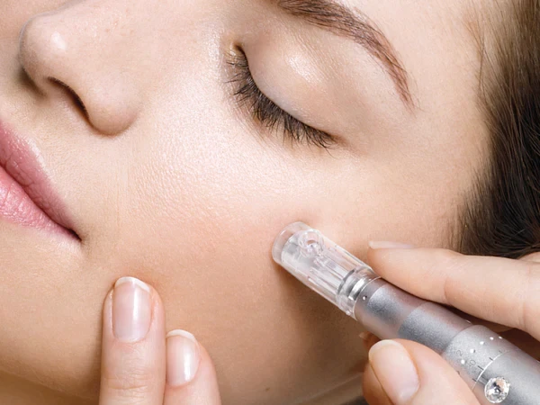 Gesichtsbehandlung mit Microdermabrasion