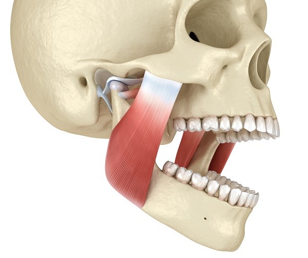 veneers