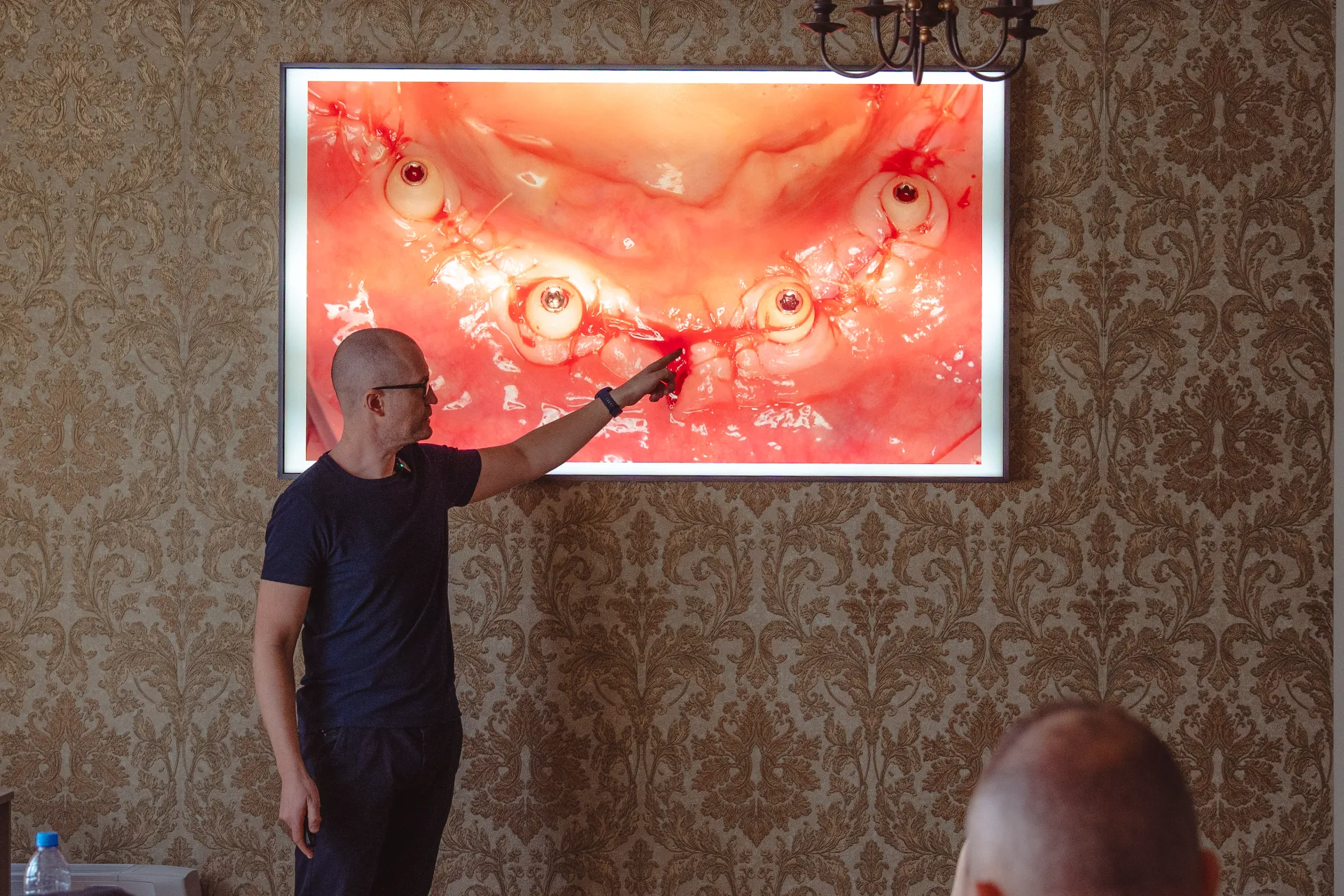 Fogászati Képzések - Implantológiai alapok - PraxEvents