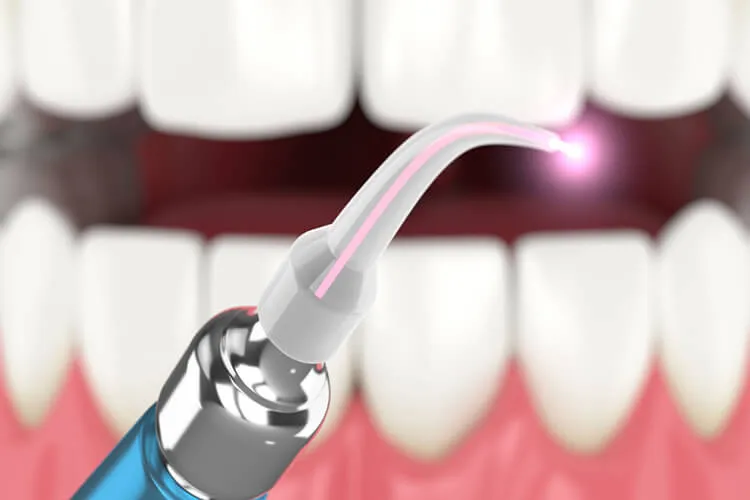 laser dentistry