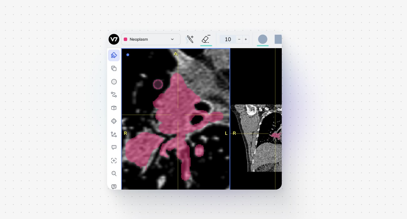 annotating with brush tool in v7