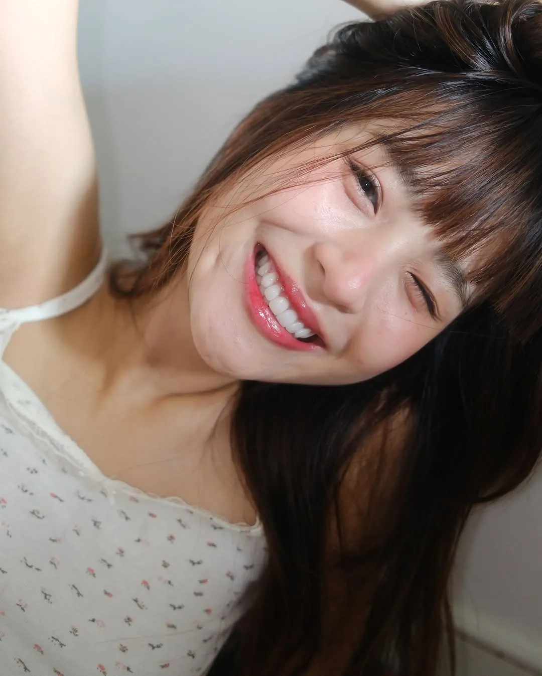 นารา คนไข้ปรับรอยยิ้มของ COSDENT Smile Design กรุงเทพฯ