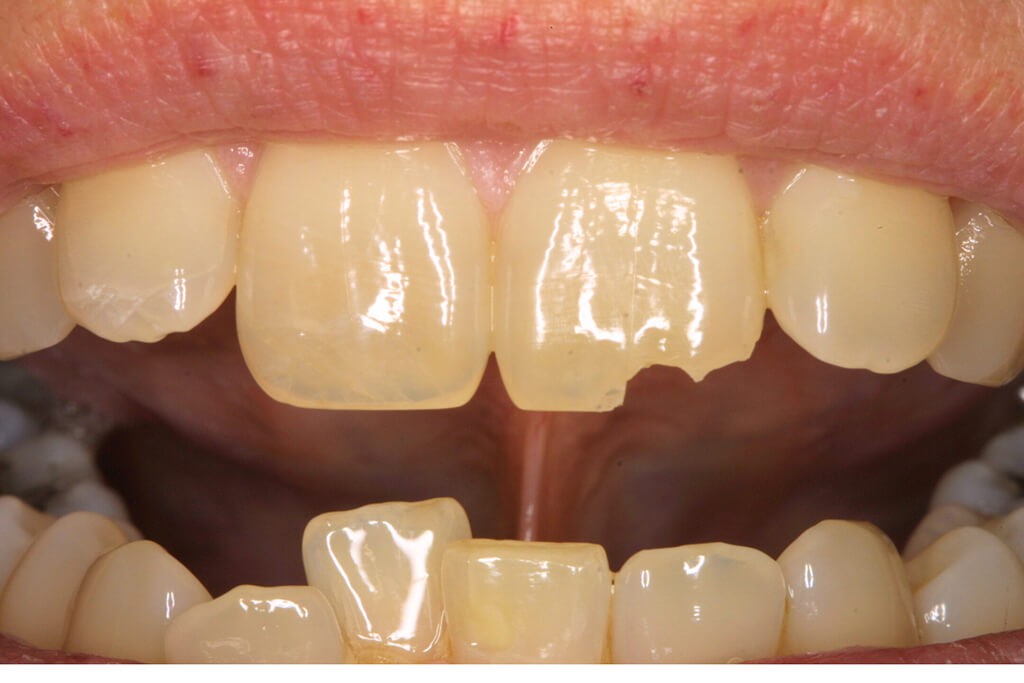 Cosmetic Dentistry Services
