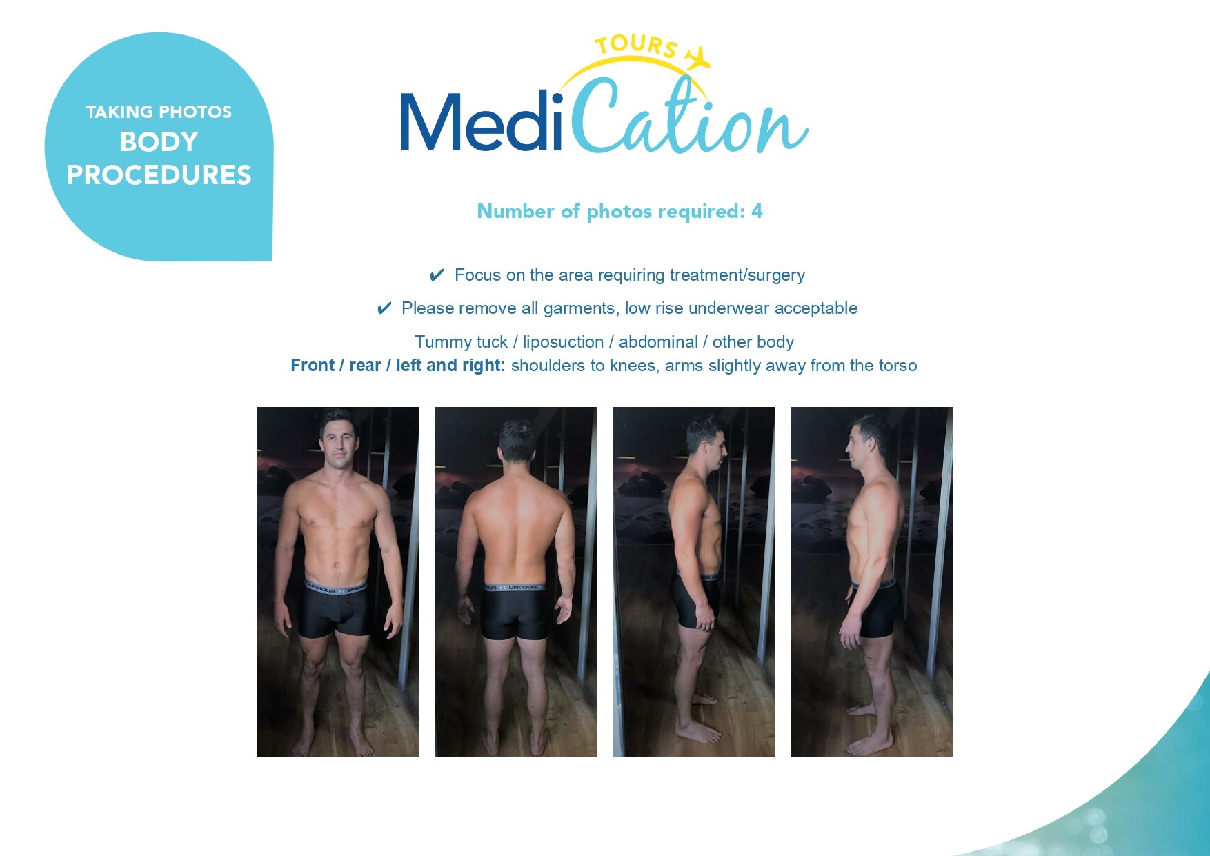 Body contouring photo guide showing multiple standing angles required for liposuction, thigh lift, and lower body surgery assessment.