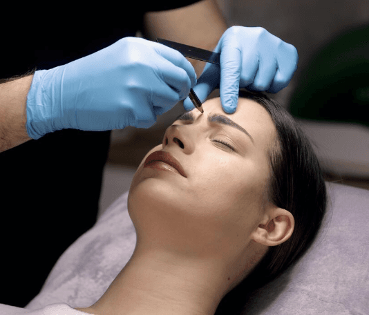 Eyebrow Hair transplant