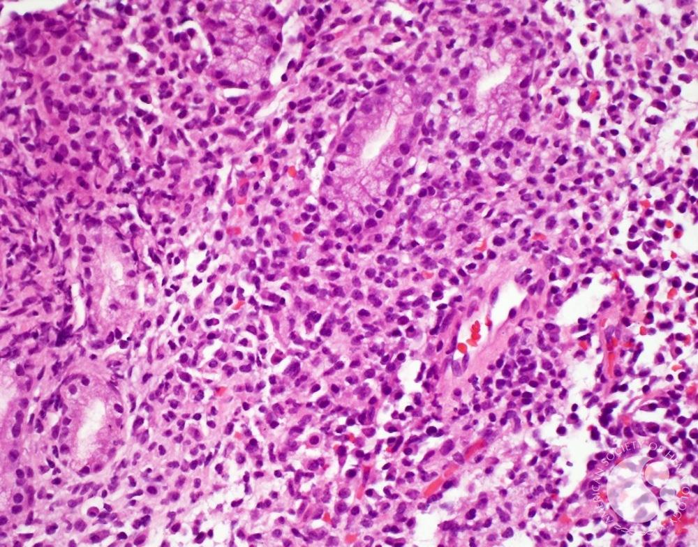 A woman with red hair and a black sleeveless top smiling confidently in a bright, modern indoor setting.