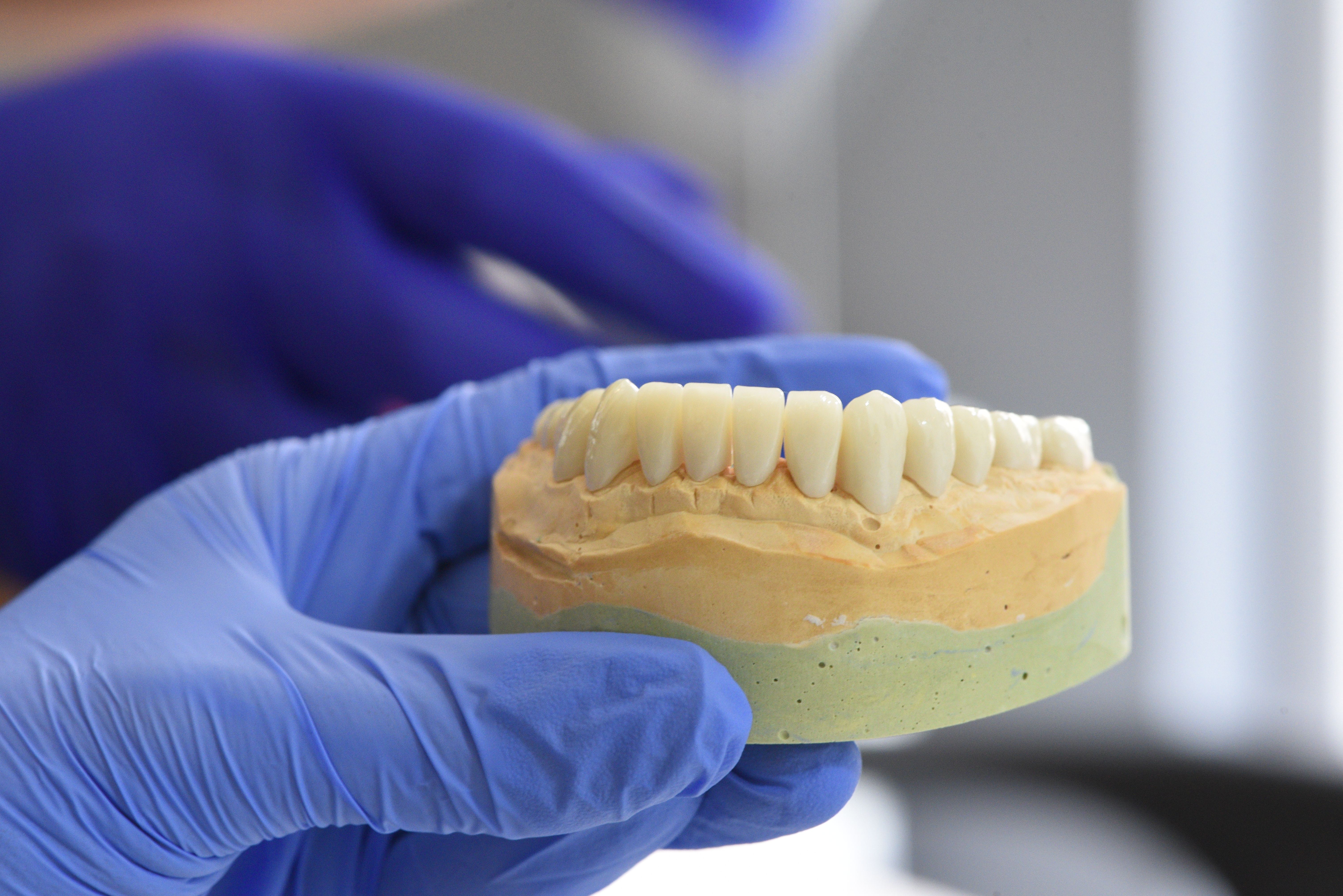 dental crown in AMK