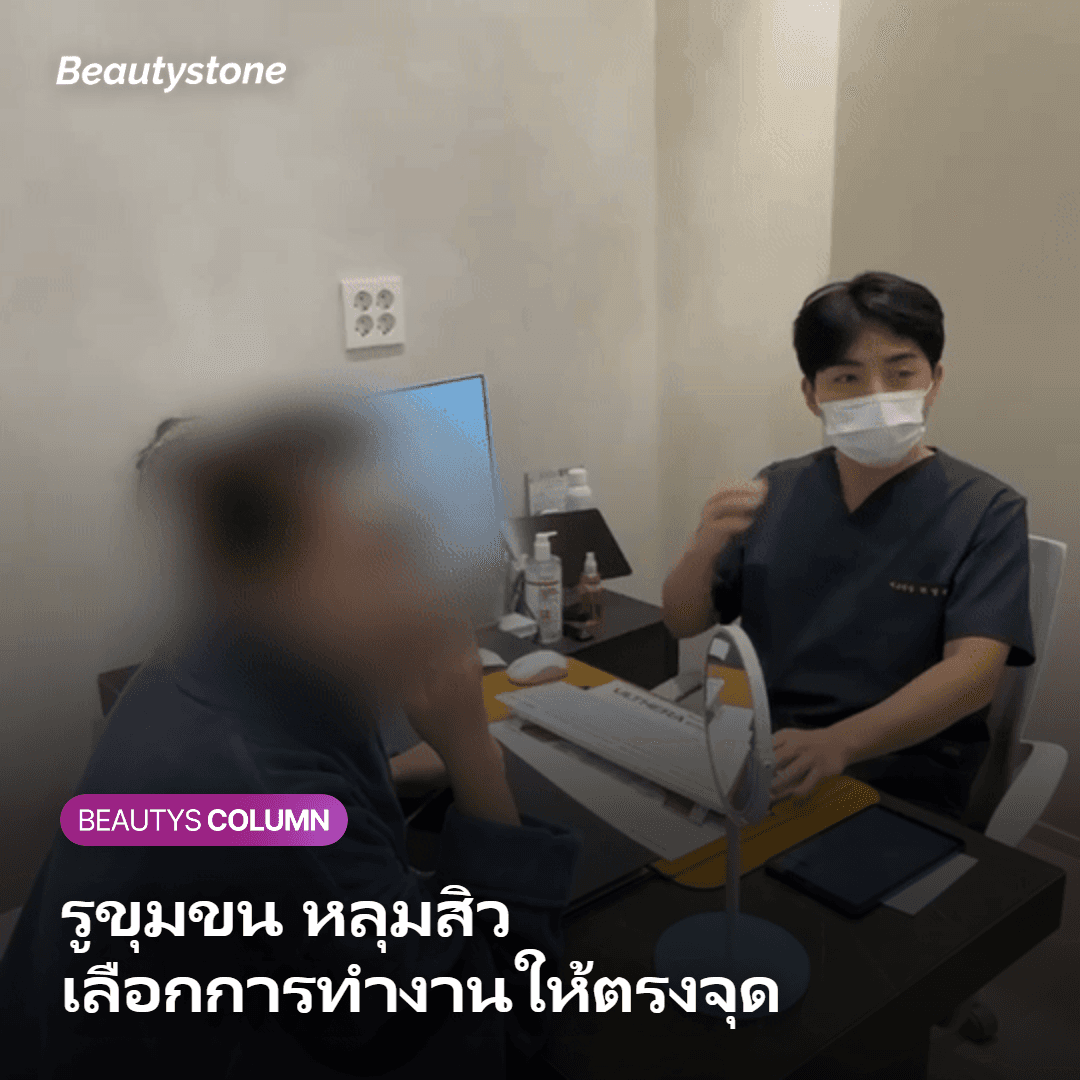 การเลือกการทำงานของ Potenza ให้เหมาะกับรูขุมขนและหลุมสิว