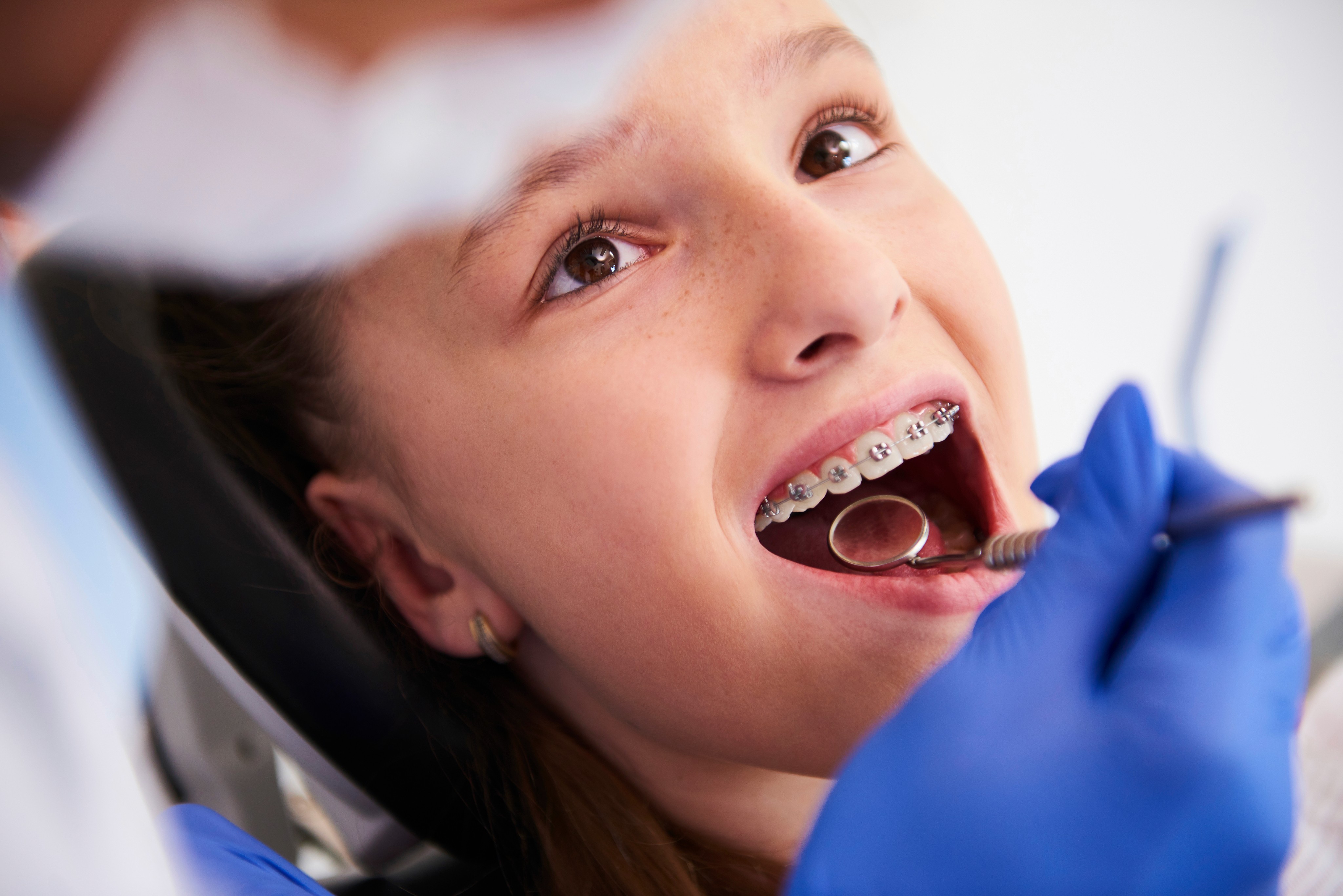 A young patient with braces having her teeth examined by a dental professional using dental tools.