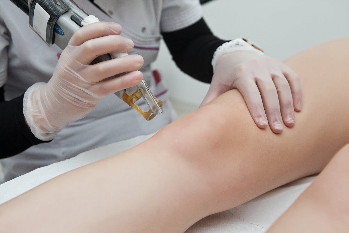 Guide to Laser Hair Removal