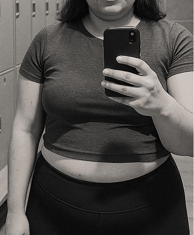 before-weight-loss