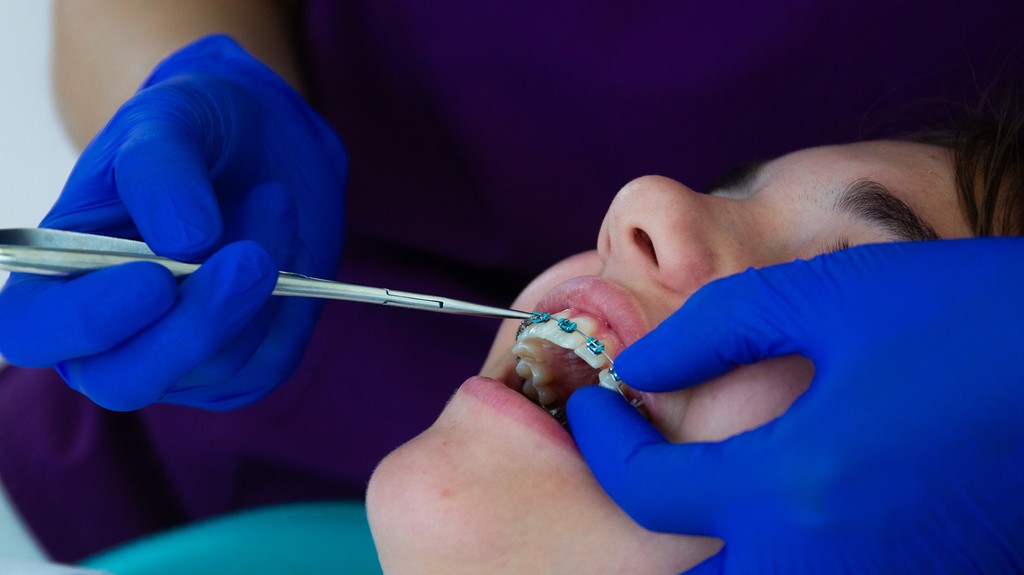 Doktorka upravuje fixný ortodontický aparát