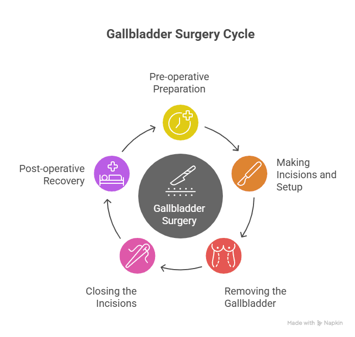Precedure of Gallbladder Surgery