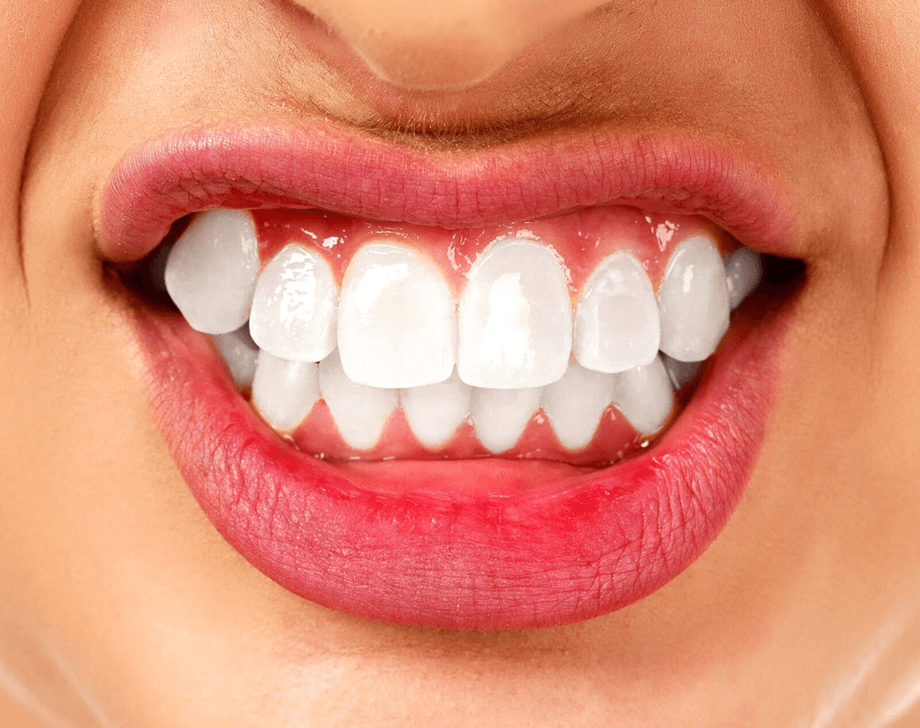 dental health