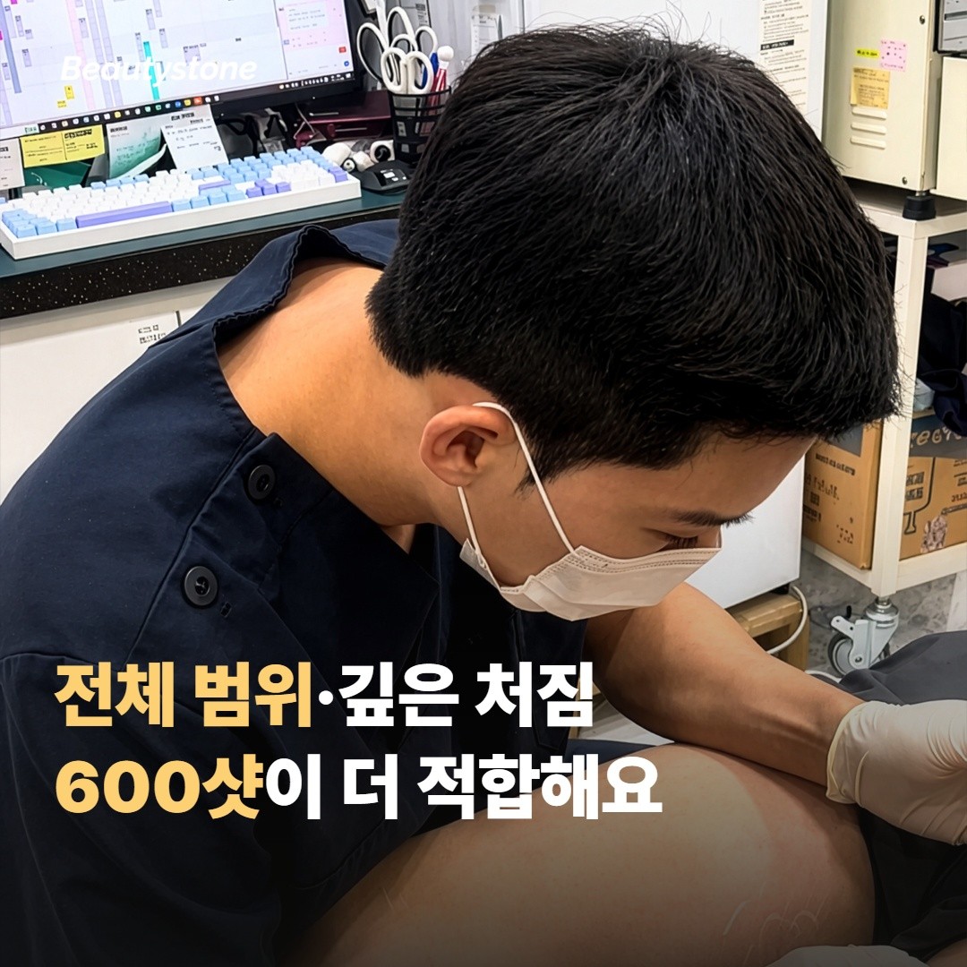 600샷이 적합한 분 — 전체 범위·깊은 처짐
