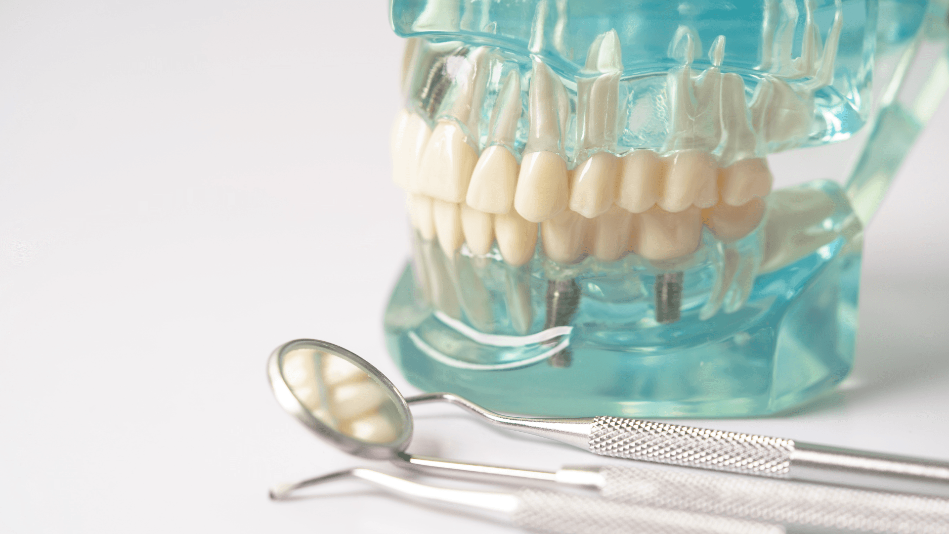 Oral surgery in Toronto at Bloor Yorkville Periodontics