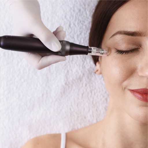 Microneedling results at Avinity Health
