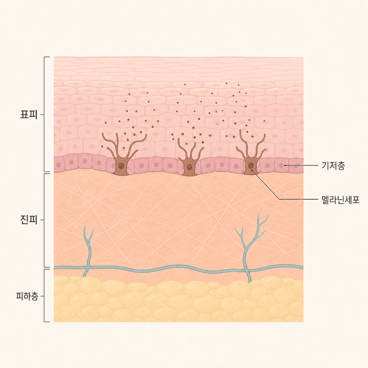 표피 기저층의 멜라닌세포와 멜라닌 분산