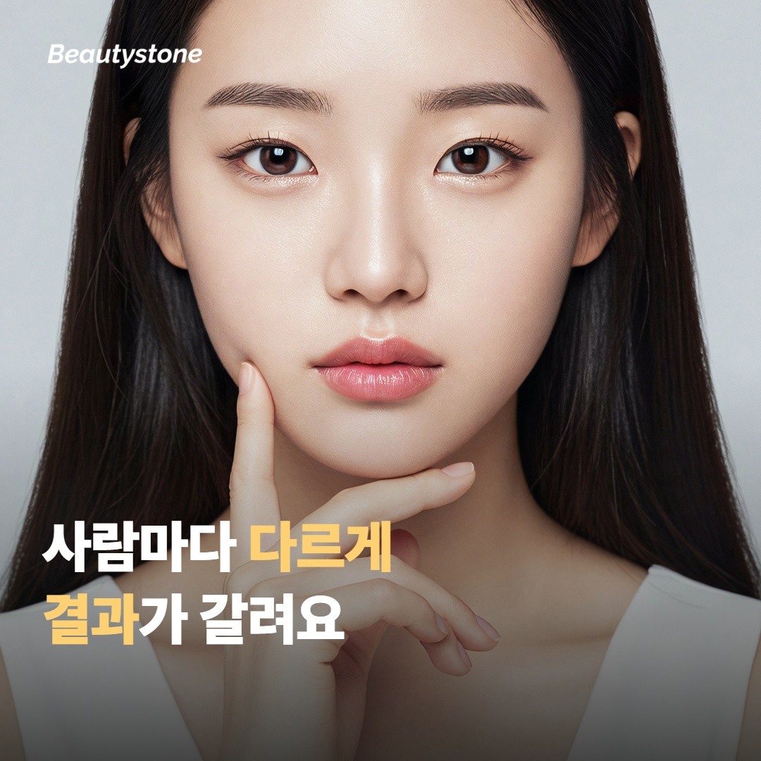 “이마 보톡스 맞고 눈이 작아졌어요” 가 자주 들리는 호소예요