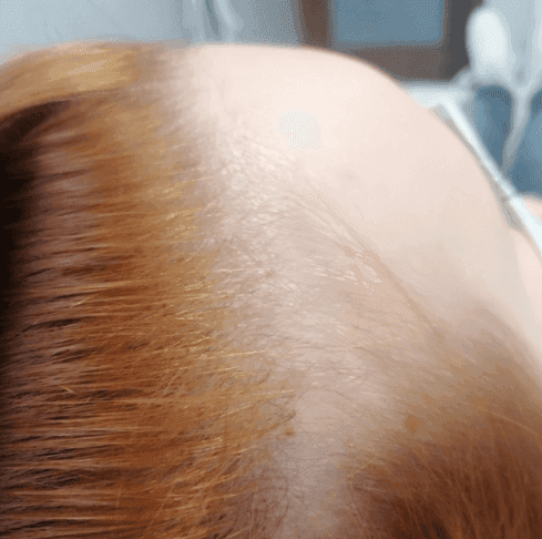 Hair Before