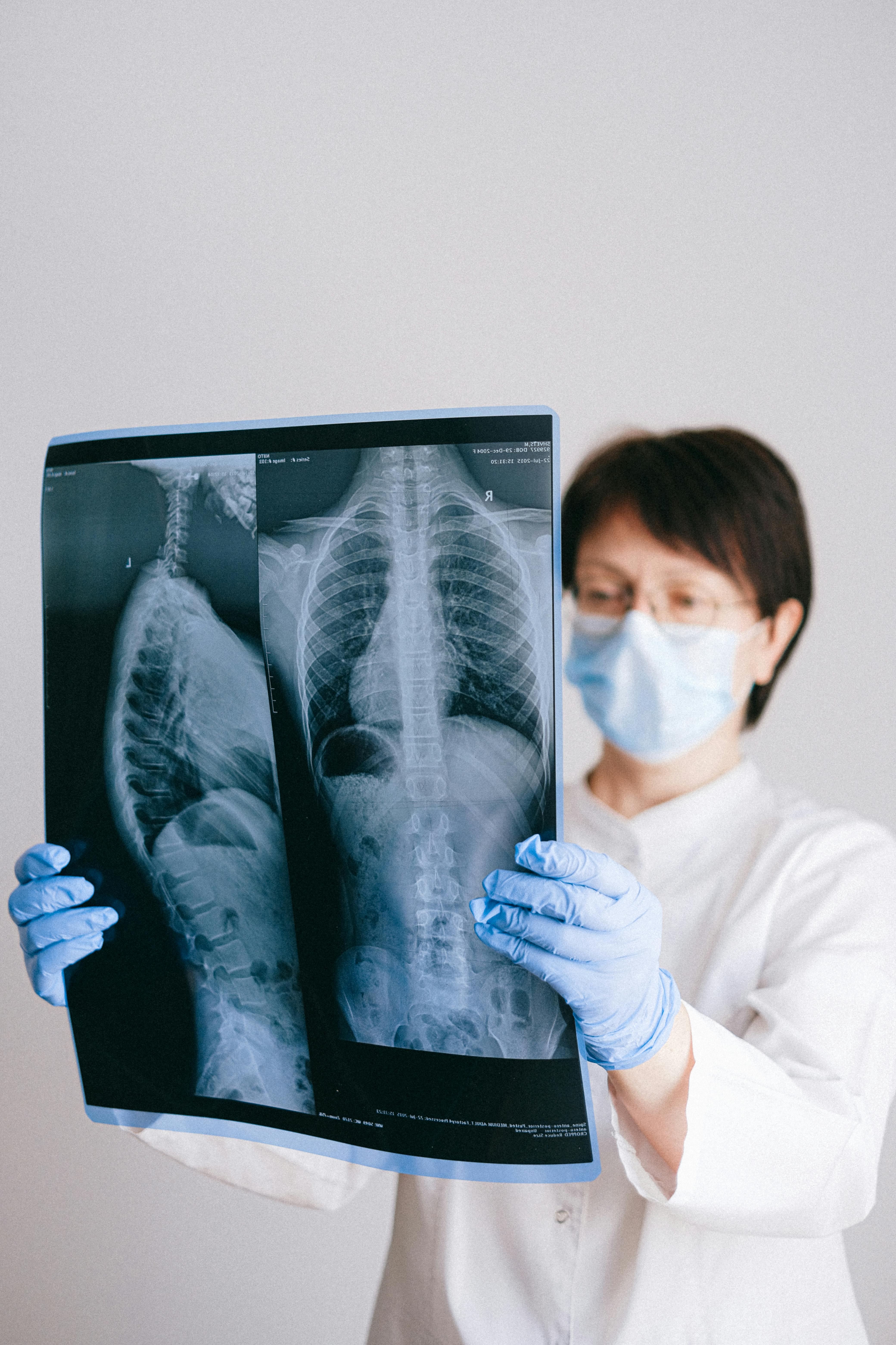 Locum radiology doctor holding patient lung X-rays for review