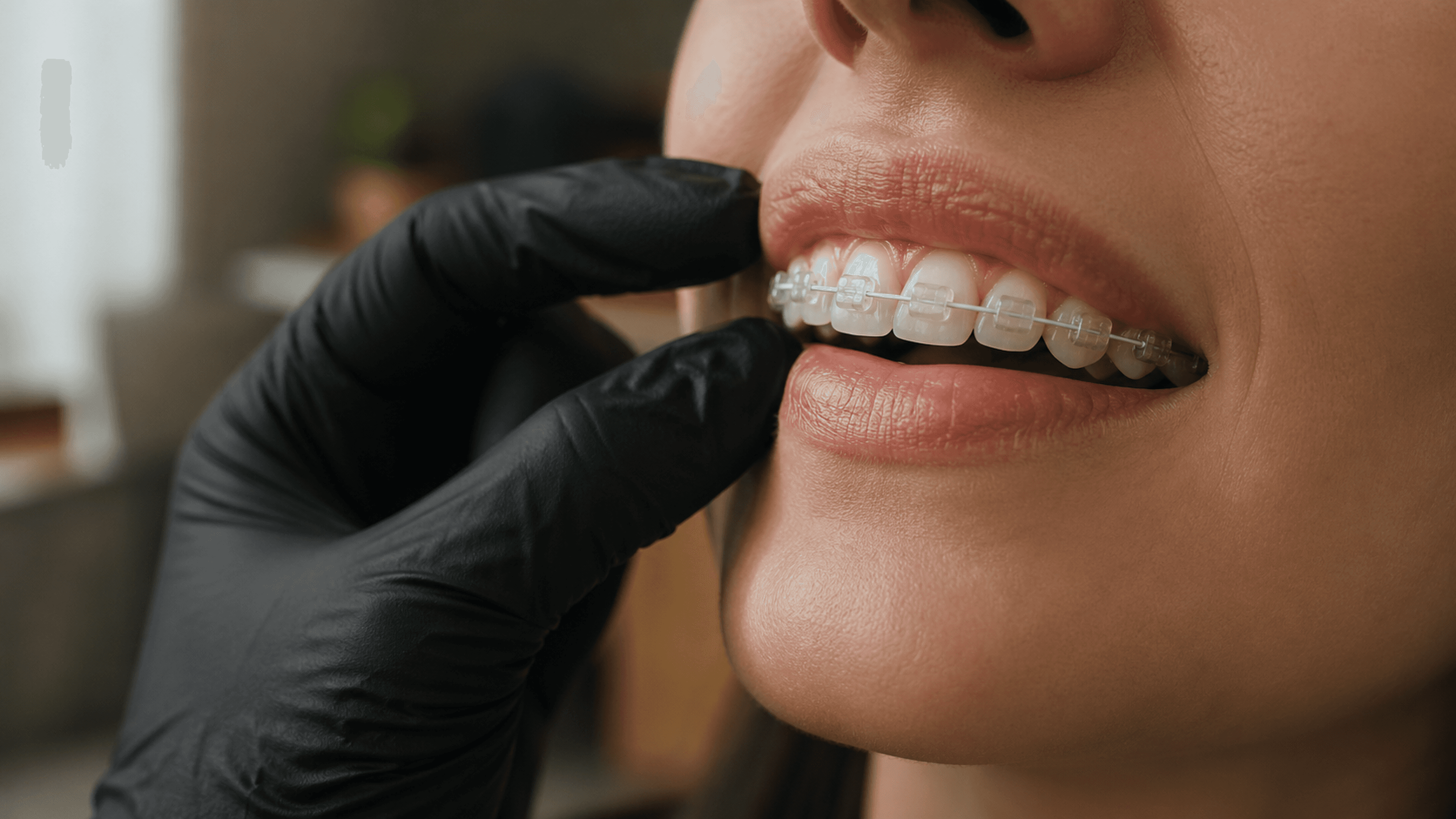 Braces